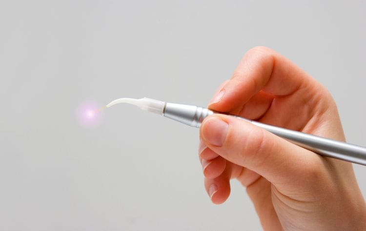 Laser Dentistry in Lyndhurst, NJ